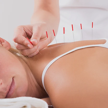 Chiropractic Foley AL Acupuncture